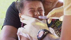 Masern-Epidemie auf Inselstaat tötet 24 Kinder