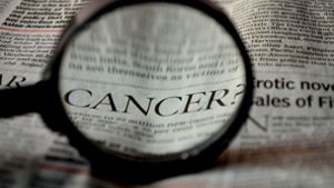Studie macht Hoffnung auf die Heilung von Darmkrebs