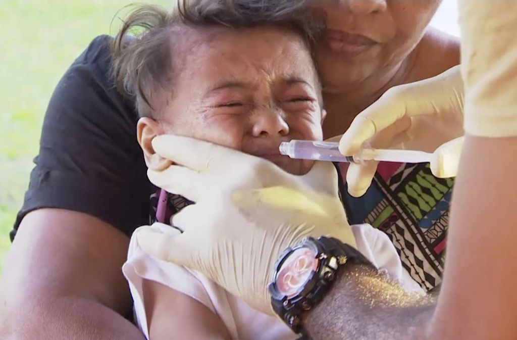Samoa: Masern-Epidemie auf Inselstaat tötet 24 Kinder