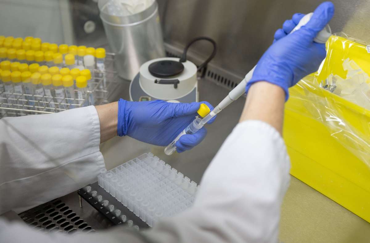 Wenn der Schnelltest positiv ist: Stadt Stuttgart empfiehlt zur Absicherung  einen PCR-Test