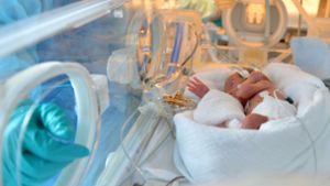 Ärzte warnen vor Schließung vieler Frühgeborenen-Stationen