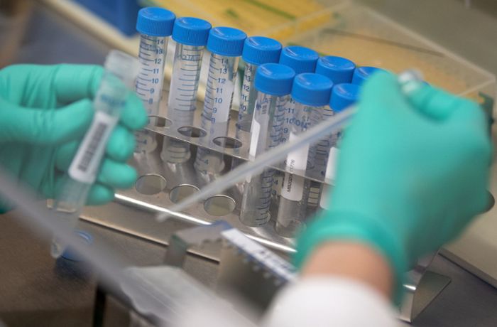 Pandemie in Deutschland: Neue Corona-Testpanne in Bayern betrifft rund 10.000 Bürger