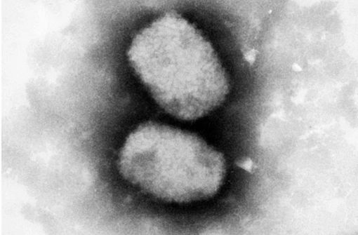 Diese vom Robert Koch-Institut (RKI) zur Verfügung gestellte elektronenmikroskopische Aufnahme zeigt das Affenpockenvirus. Foto: /RKI/dpa/Andrea Männel