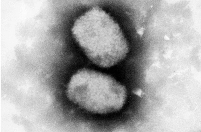 Was ist das Affenpockenvirus und wie gefährlich ist es?