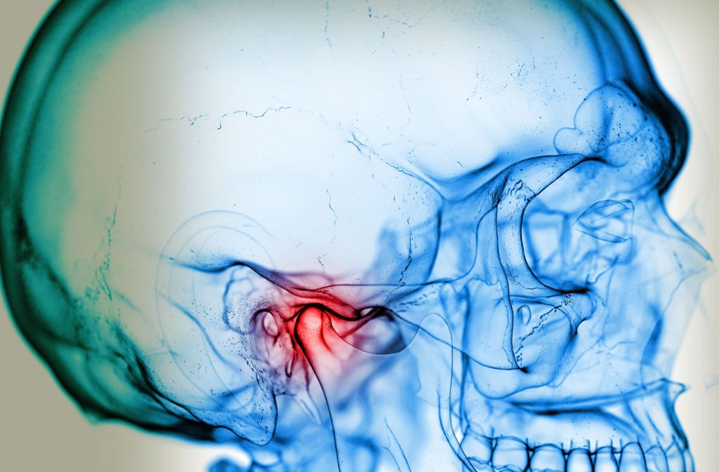 Kopfschmerzen, Migräne, Tinnitus: Sitzt das Unheil im Kiefer?